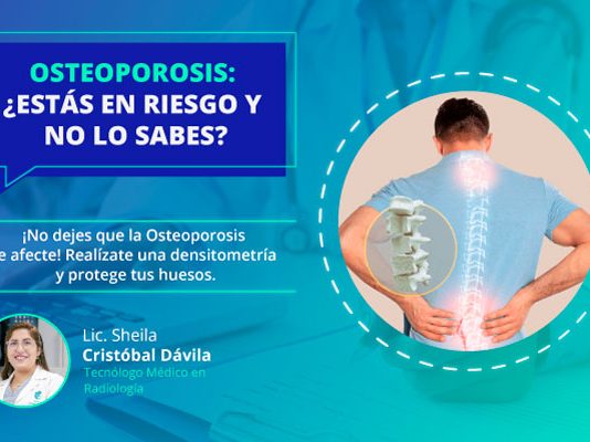 Densitometría ósea en Huancayo